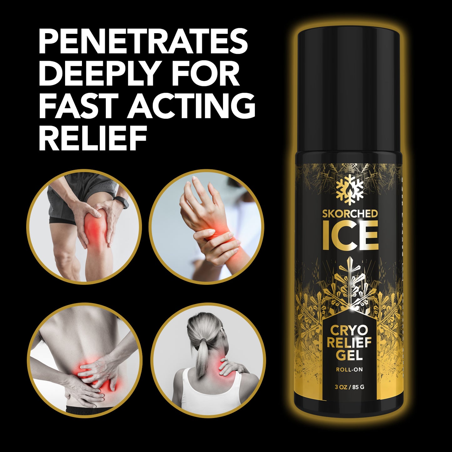 Skorched Ice Cryotherapy Roll-on